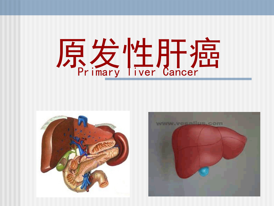 原发性肝癌541_第1页