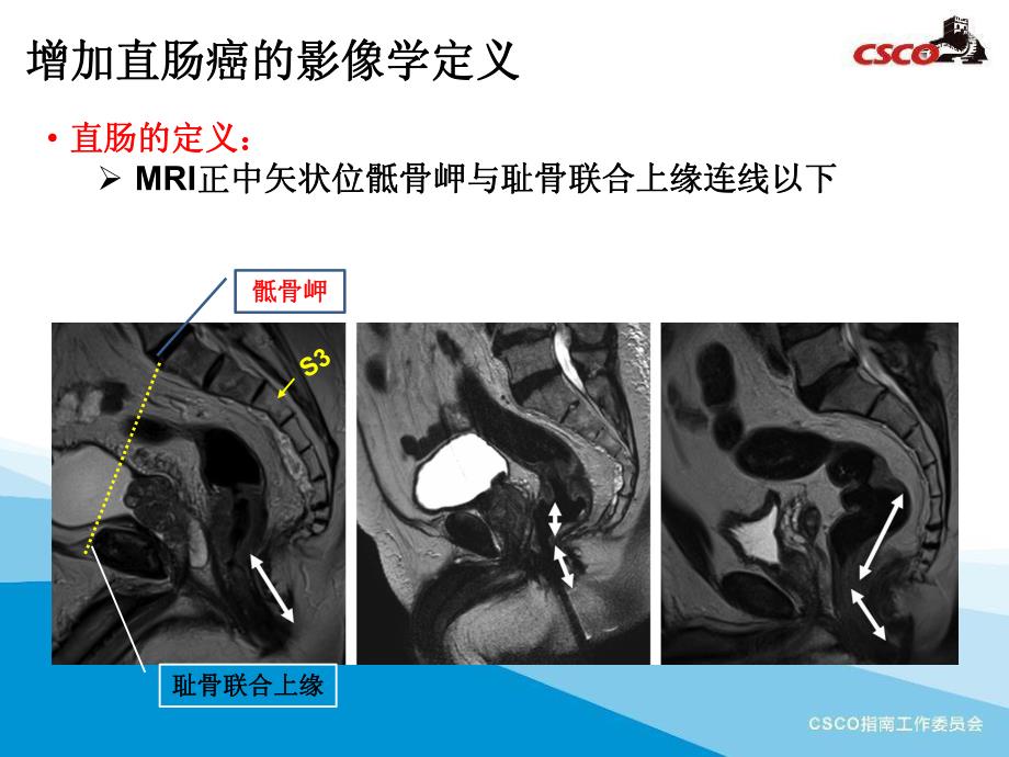 2019结直肠癌诊疗指南更新版解读- 外科及辅助_第3页