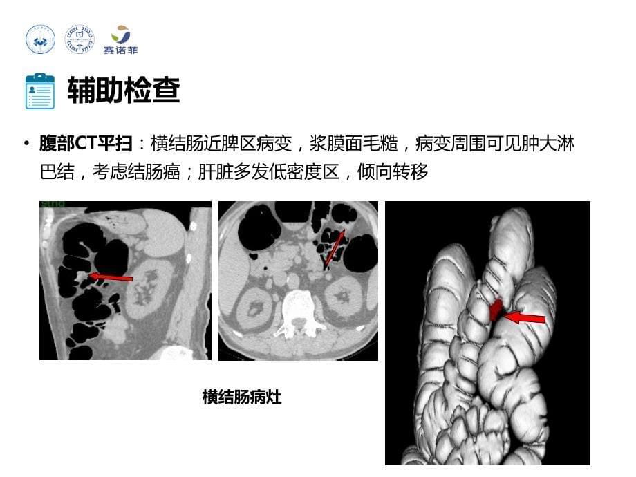 IV期潜在可切除成功转化-0626_第5页