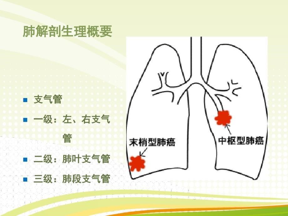 肺癌病人护理.2_第5页