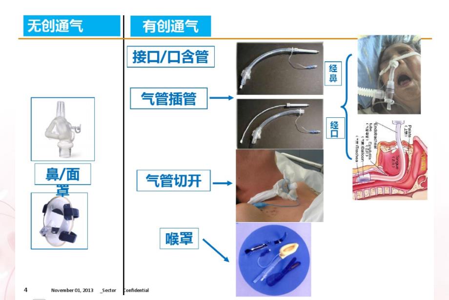 无创呼吸机通气模式介绍及临床应用机械通气教材(PPT 47页)_第4页