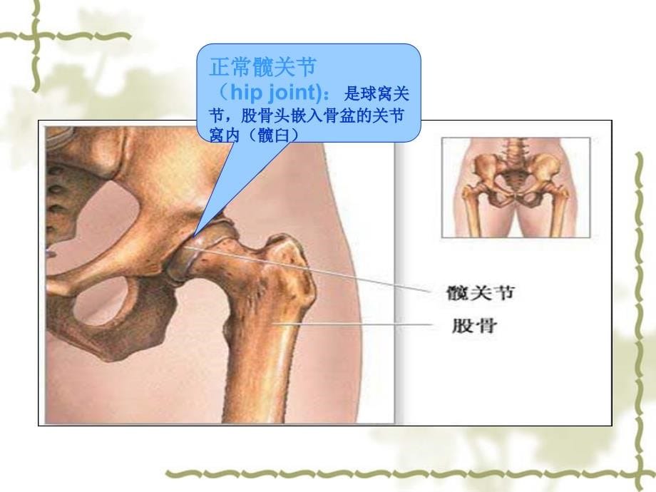 股骨颈骨折病人护理(2)_第5页