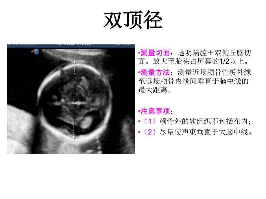 产科检查常规切面_第3页