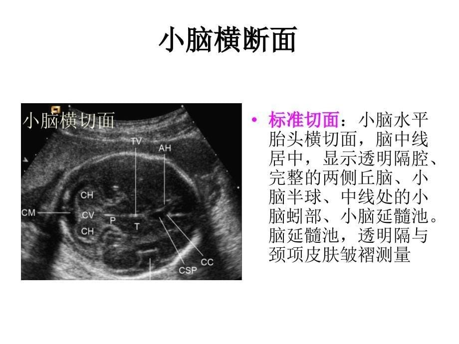 产科检查常规切面_第5页