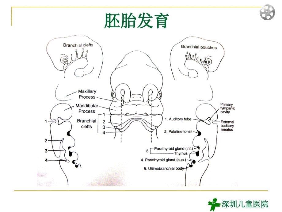 儿童鳃裂畸形超声诊断2013年_第5页