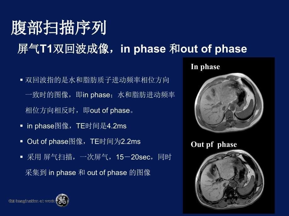 MRI在腹部疾病中应用_第5页