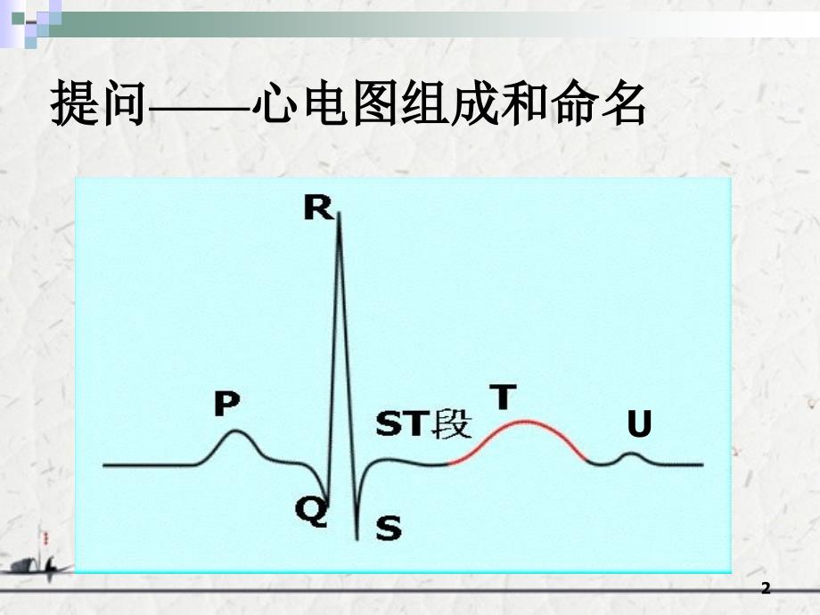 心电图类型和表现_第2页