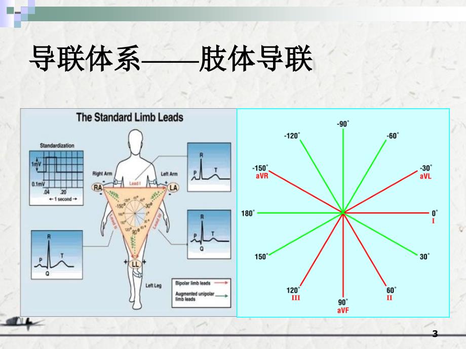 心电图类型和表现_第3页