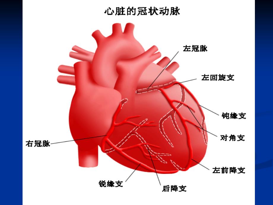 冠心病外科现状与手术_第3页