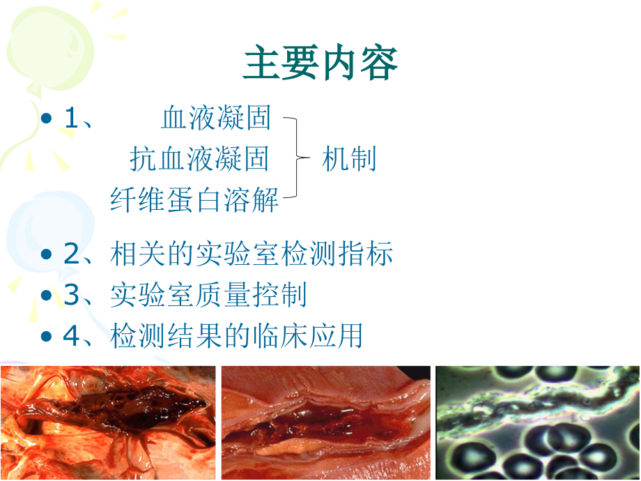 血栓性疾病实验室诊断2016年3培训_第4页