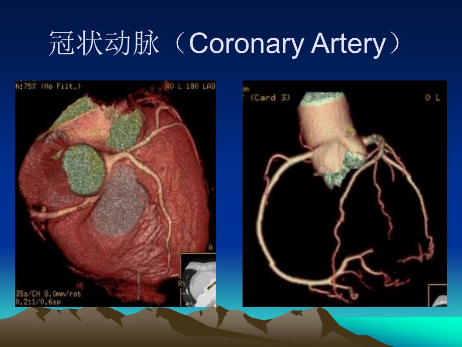 冠状动脉解剖要点_第4页