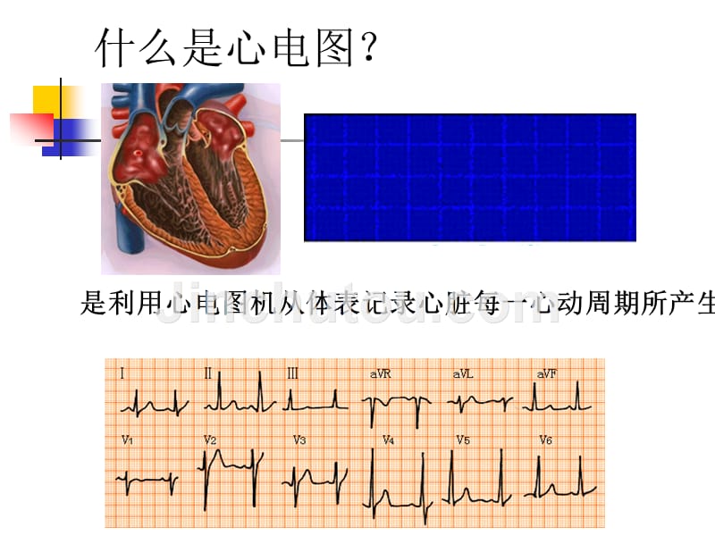 正常心电图第二实验室马彦娟_第4页