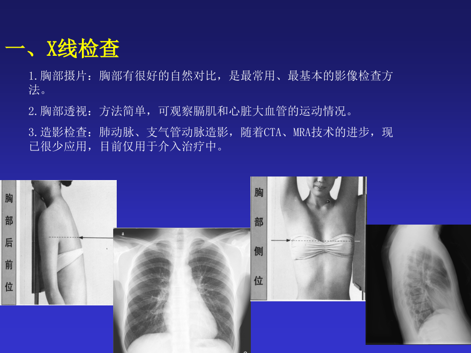 影像学-呼吸系统zjb_第4页