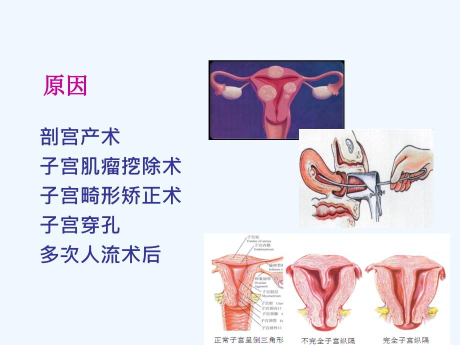 产后出血指南镇海_第1页