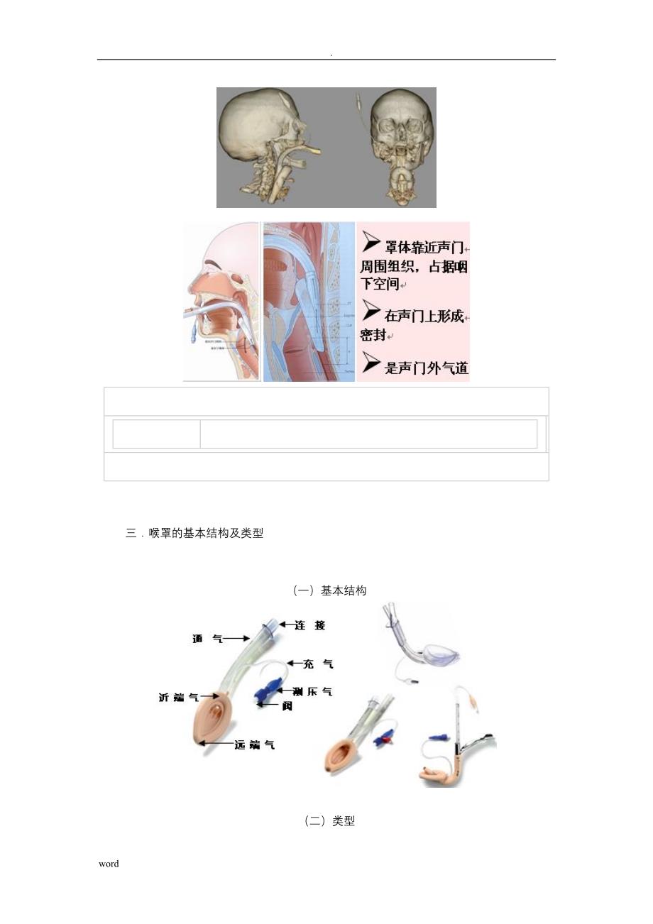 喉罩及临床应用_第2页