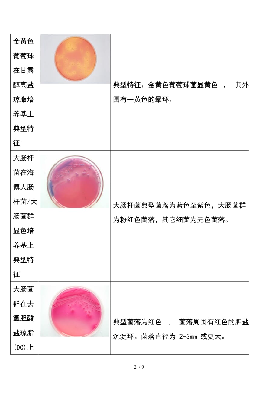 微生物菌落特征形态等总结大全表格带图片_第2页