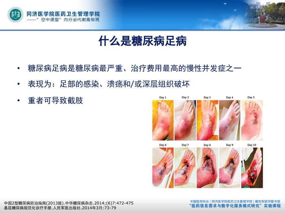 高级班第9讲_糖尿病足病(网络版)_第3页