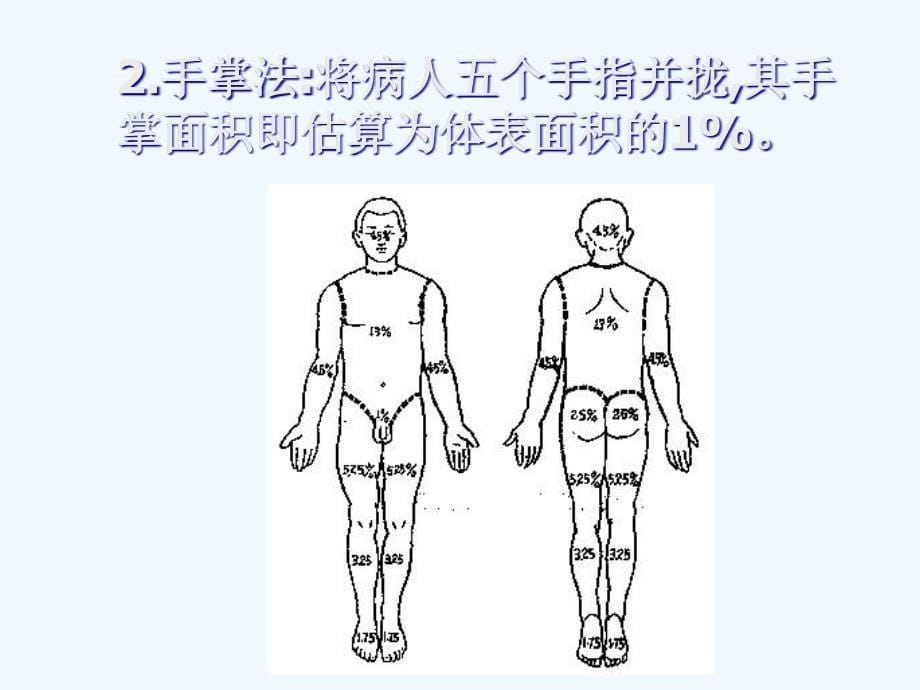 急性烧烫伤的急救济南市中心医院_第5页