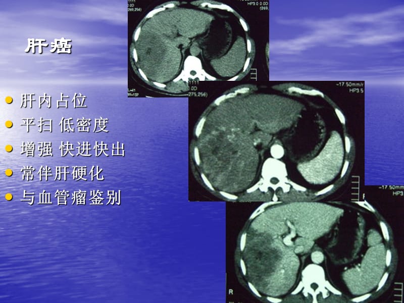 执业医师技能考试 X线、CT、B超辅导(下)_第4页