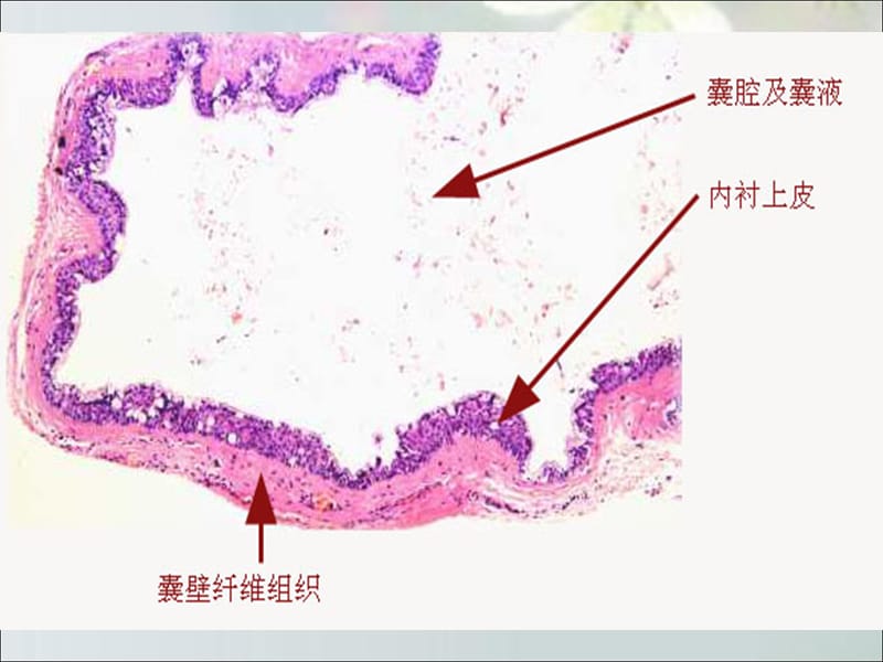 第16章--口腔颌面部囊肿_第4页