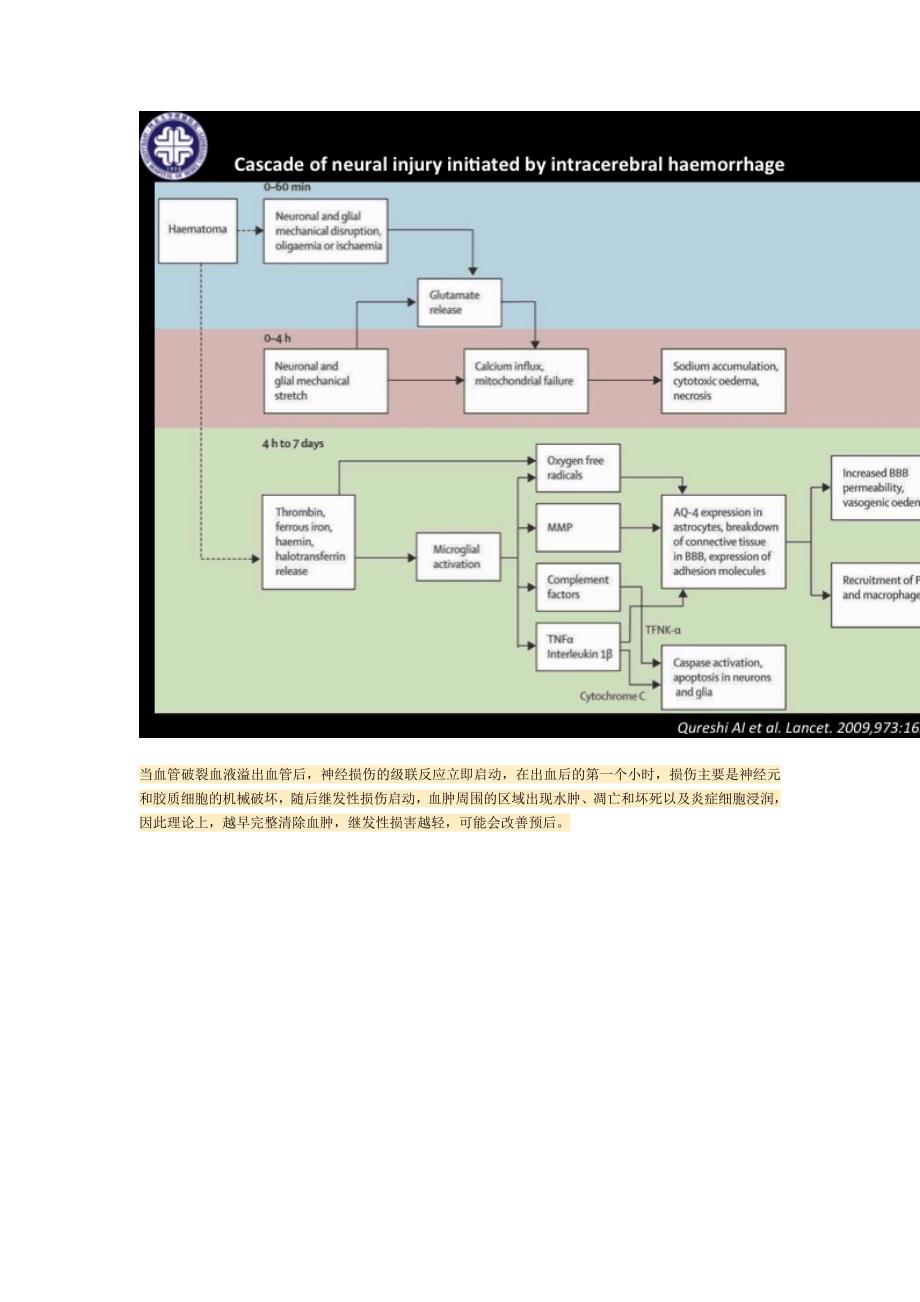 小骨窗经侧裂入路治疗基底节区脑出血课件_第4页