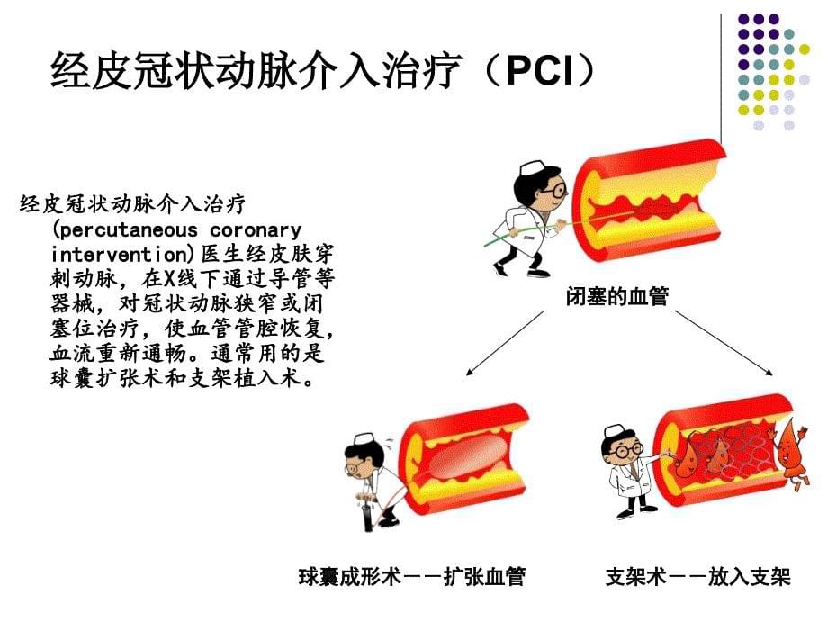 一例绿色通道急诊PCI的心肌梗死病例课件_第5页