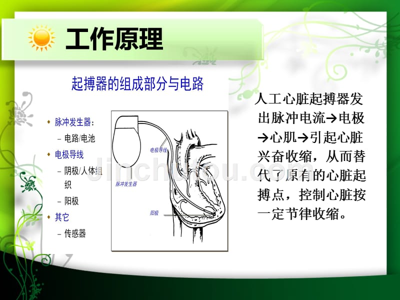 临时起搏器的护理 ppt课件_第4页