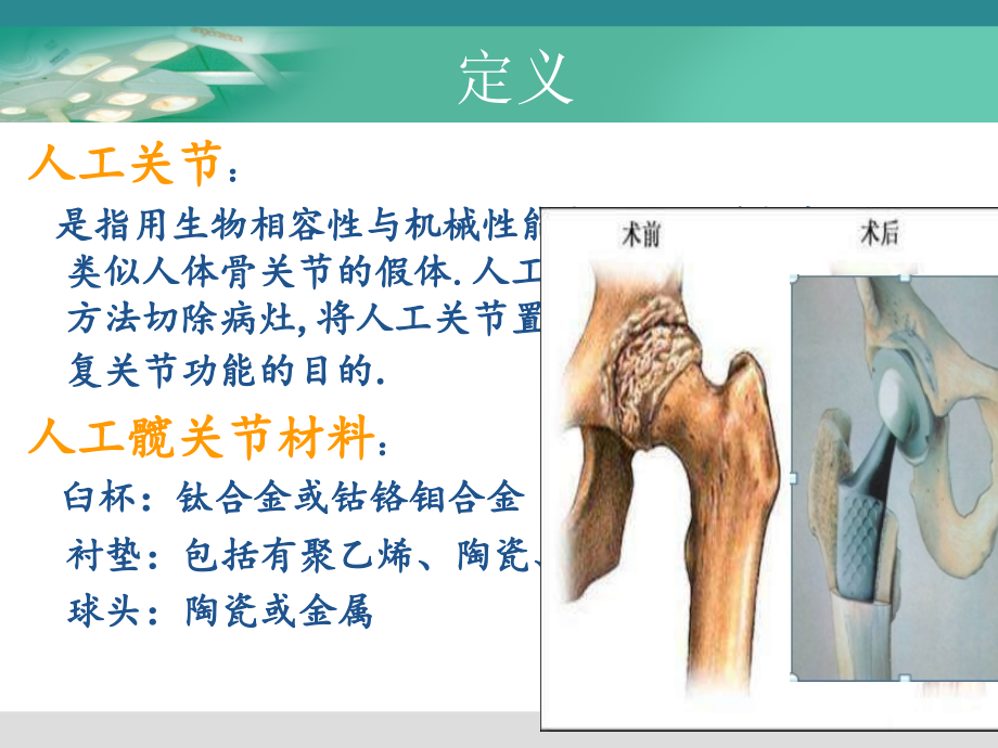 全髋置换护理查房 ppt课件_第4页