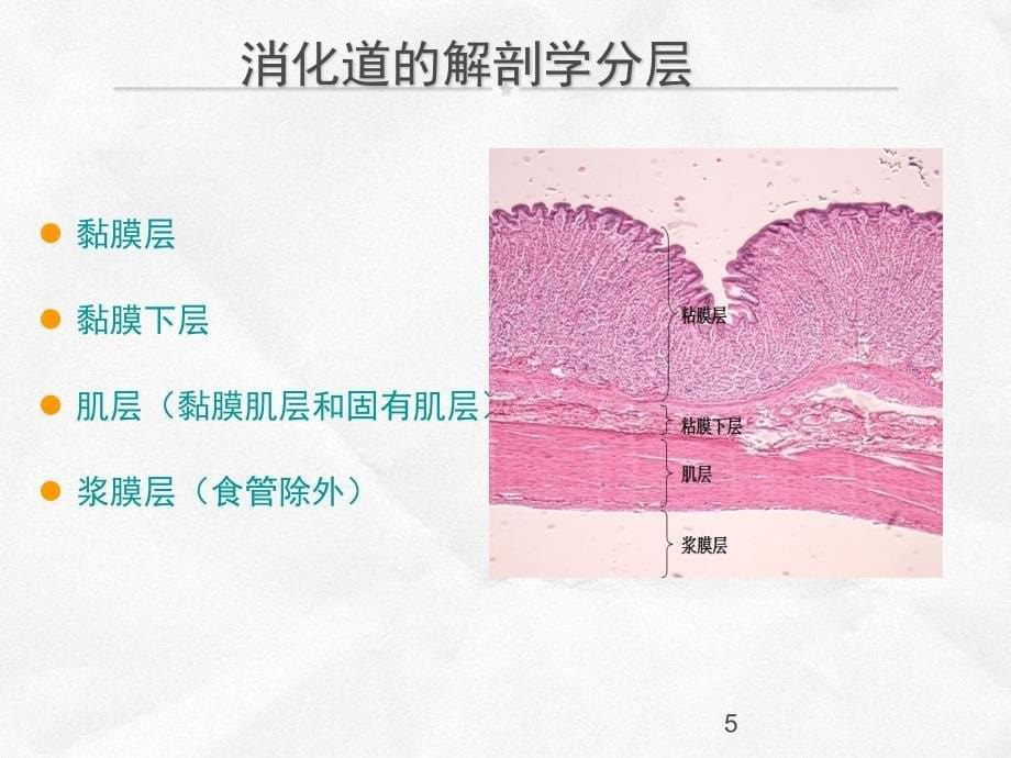 ESD患者的治疗及护理ppt课件.ppt_第5页