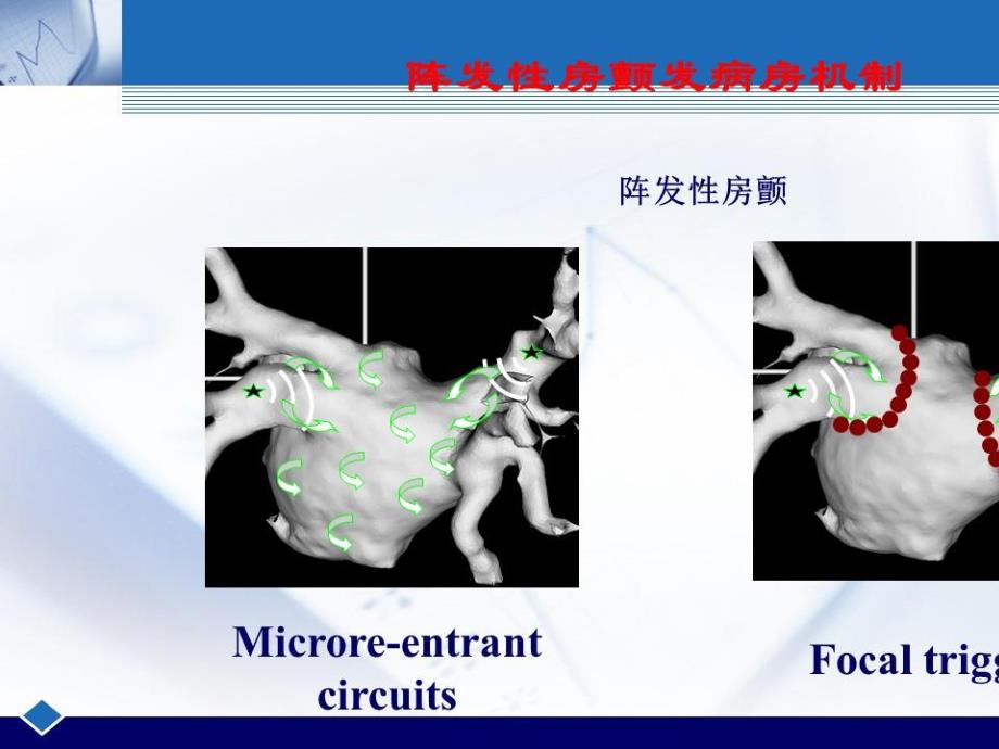 房颤转子识别与标测_第3页