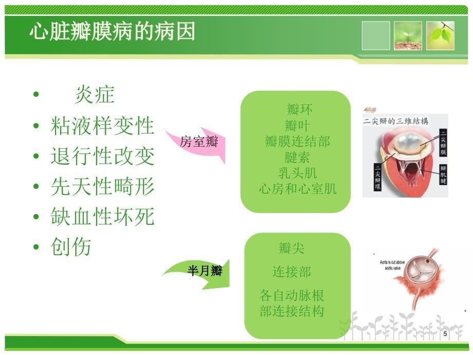 心脏瓣膜成形术ppt课件.ppt_第5页