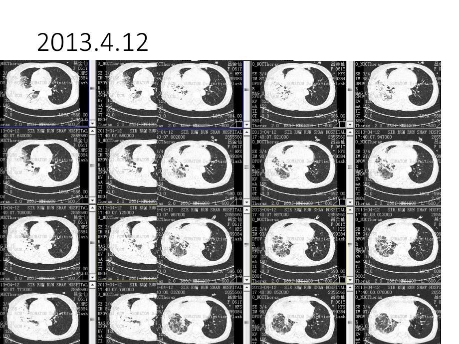 抗感染治疗ppt课件.ppt_第3页