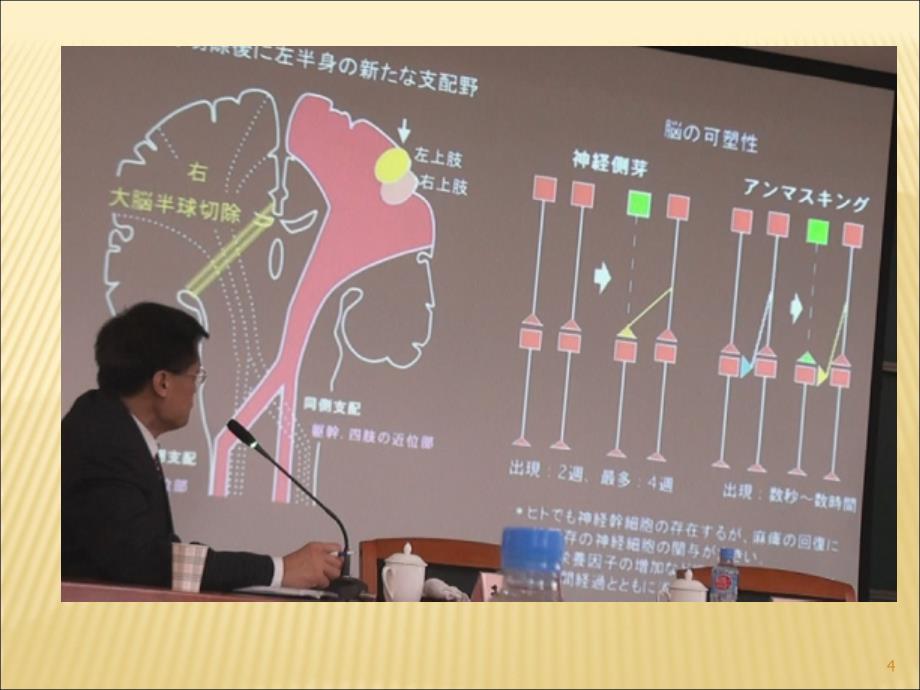 神经促通技术概述ppt课件.ppt_第4页