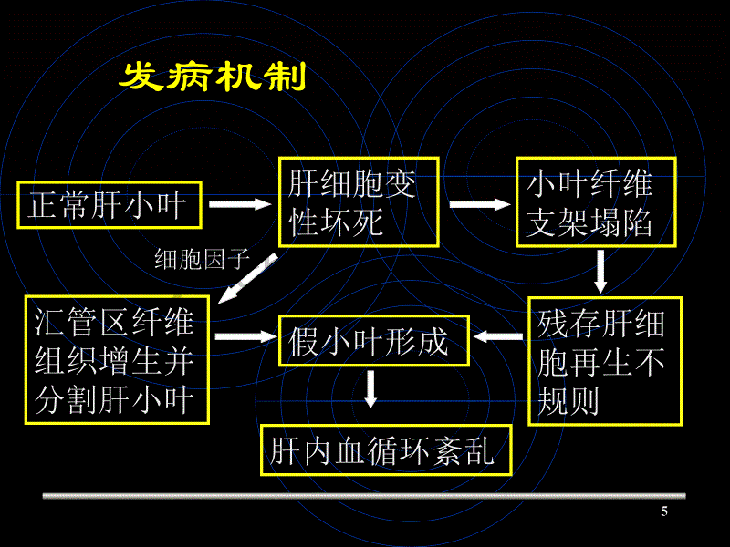 肝硬化ppt课件 (8).ppt_第5页