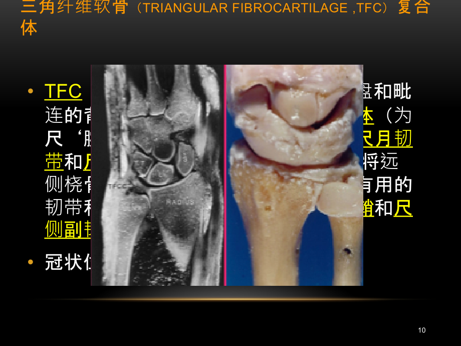 腕关节疾病的MRI诊断和解剖ppt课件.pptx_第2页