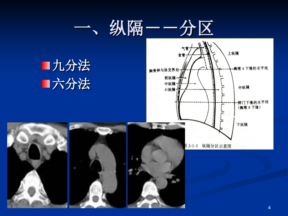 胸部常见疾病CT诊断与鉴别诊断ppt课件.pptx_第4页