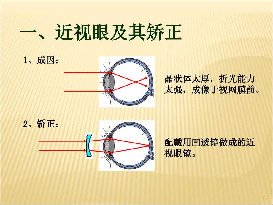 近视眼与远视眼的成因及矫正ppt课件.ppt_第4页