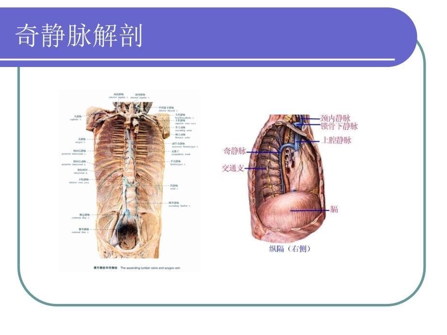 PICC管的X线定位(1)_第5页