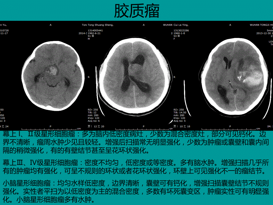 典型病例影像表现PPT课件.ppt_第2页