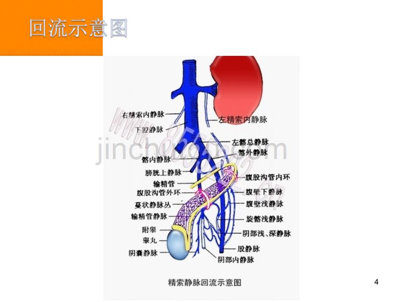 精索静脉曲张精品课件.ppt_第4页