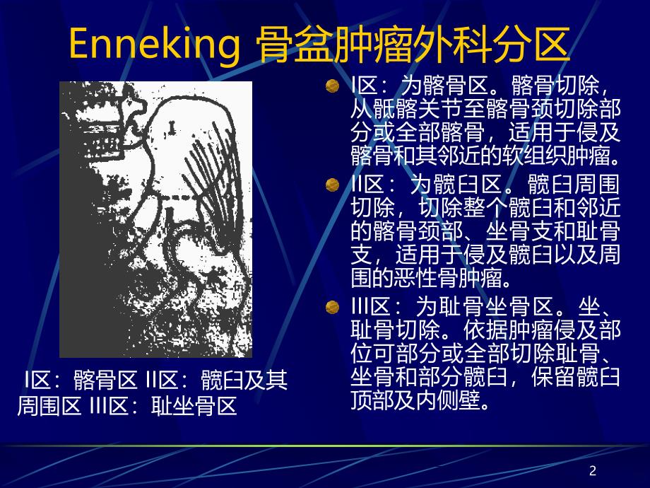 骨盆肿瘤典型病例PPT课件.ppt_第2页