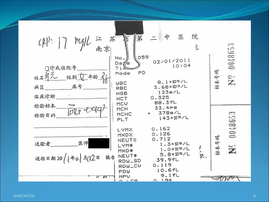 感冒中医治疗综述PPT课件.ppt_第4页