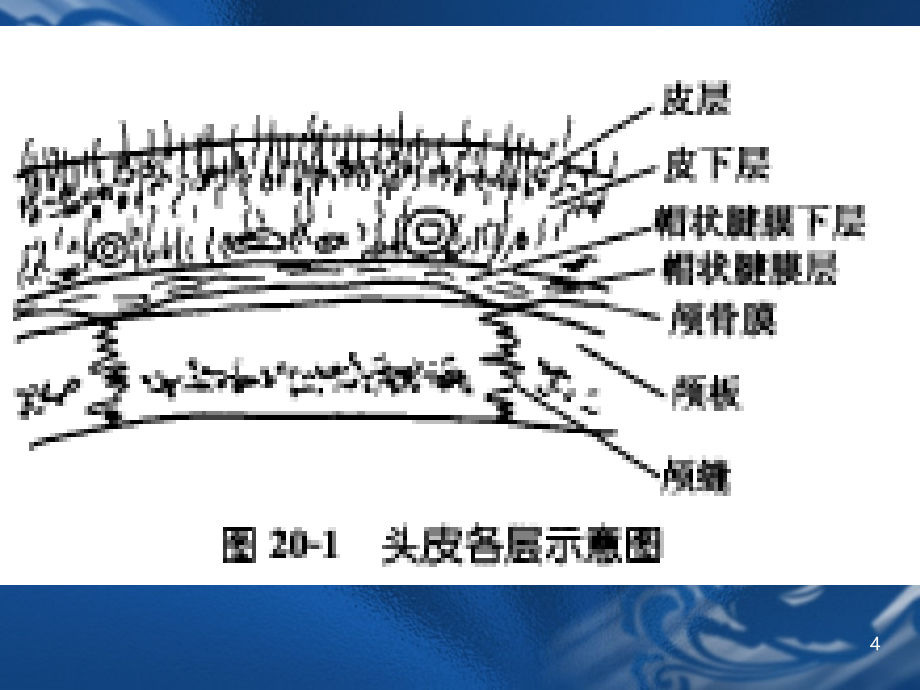 《颅脑损伤备课》PPT课件.ppt_第4页