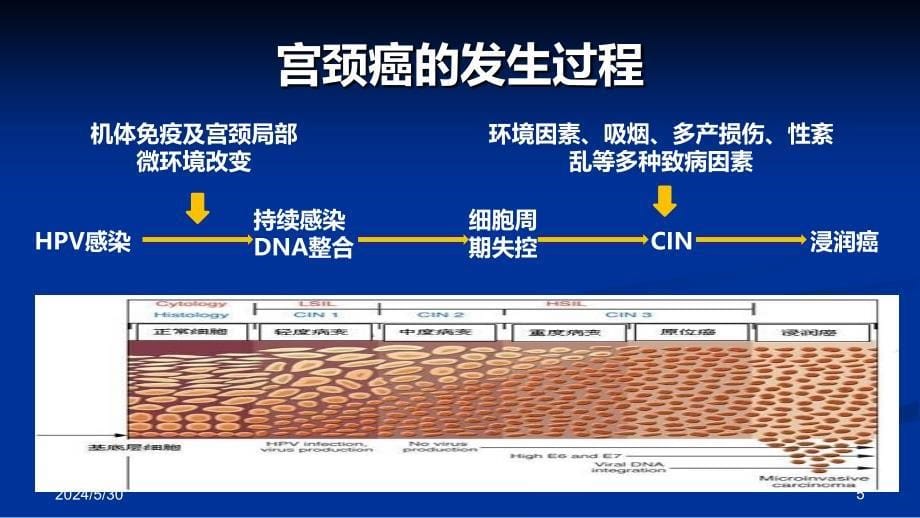 浅谈宫颈癌 贾朝阳PPT课件.ppt_第5页