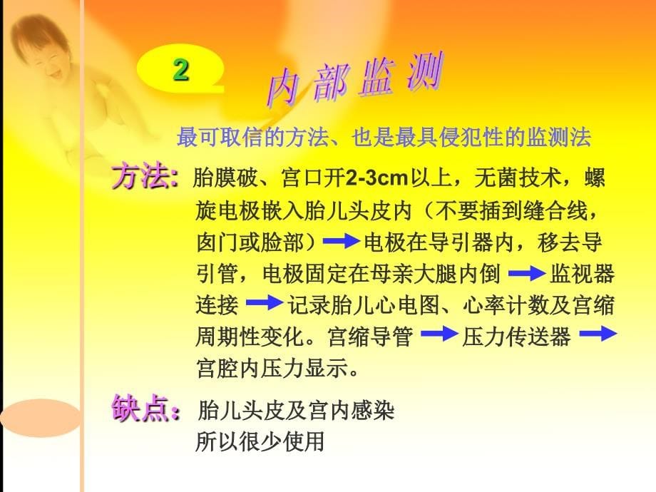 电子胎心监护解读新进展完整版.ppt_第5页