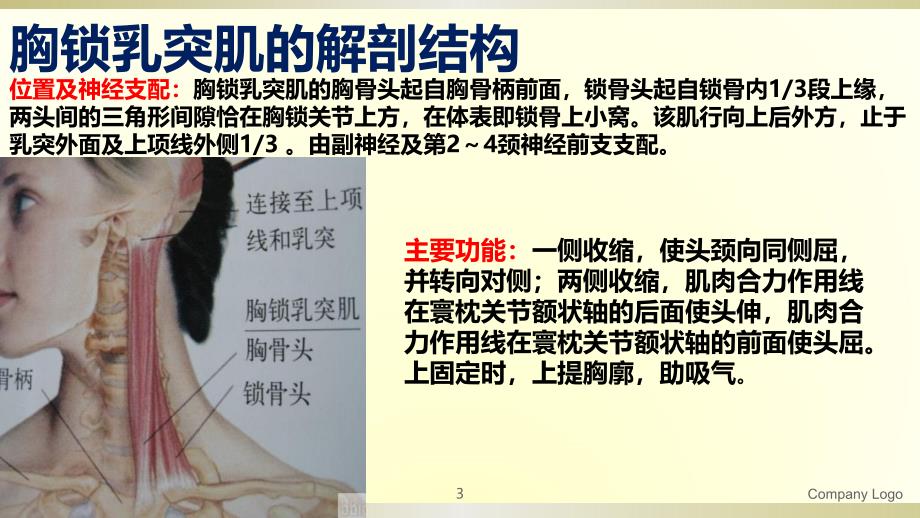 小儿肌性斜颈的康复治疗PPT课件.ppt_第3页