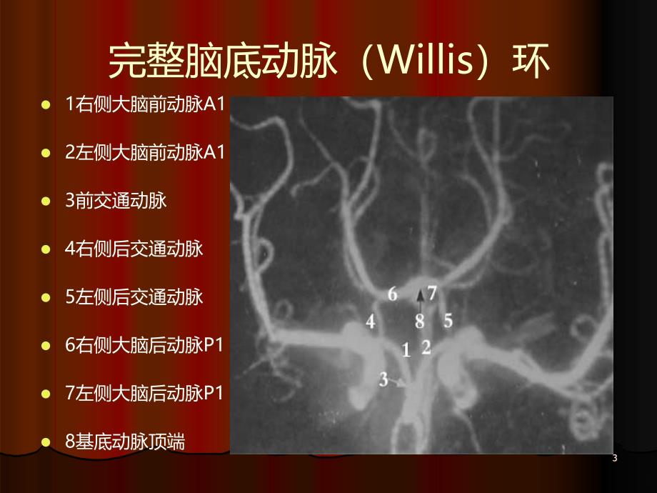 大脑前动脉动脉瘤 用PPT课件.ppt_第3页