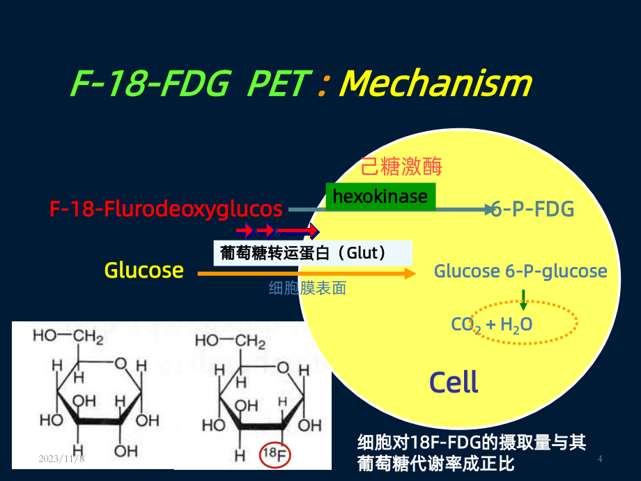 PET在头颈部恶性肿瘤中的应用PPT课件.ppt_第4页