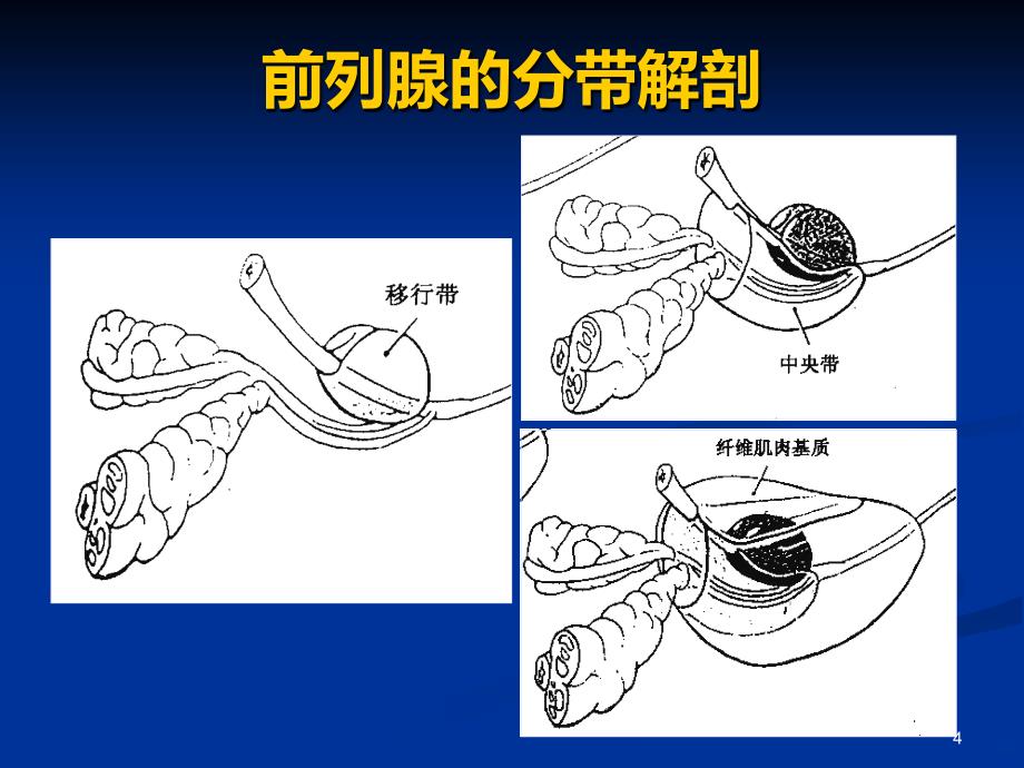 前列腺的MR检查PPT课件.ppt_第4页