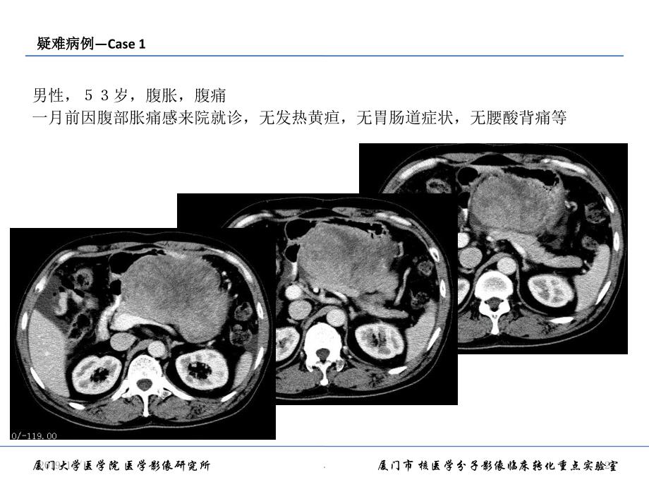 腹膜后占位的影像诊断思路PPT课件.ppt_第2页